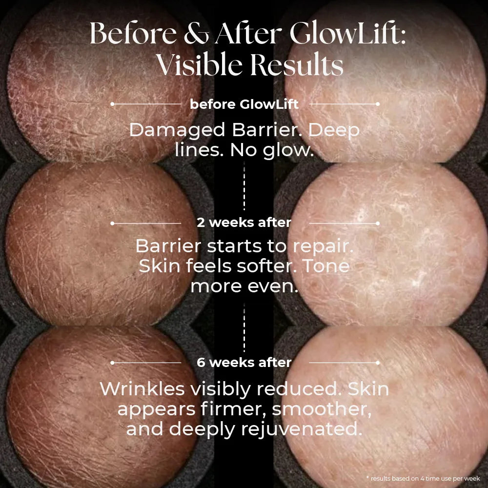 GlowLift™ Infinity | 5-In-One Sculptor & Radiance Booster